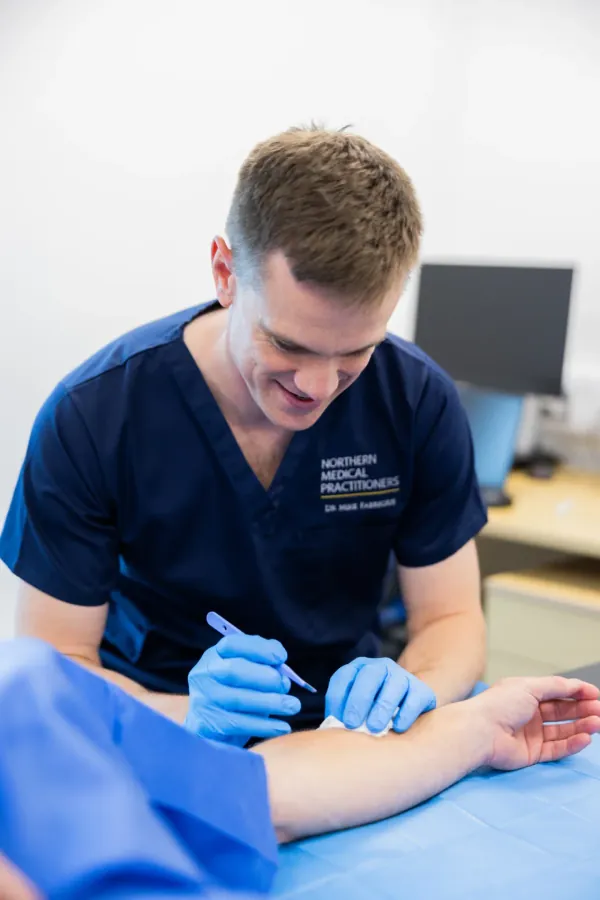 Private wart removal at Northern Medical